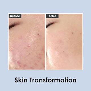 Centella Mezzo Cream 30ml - MEDI-PEEL