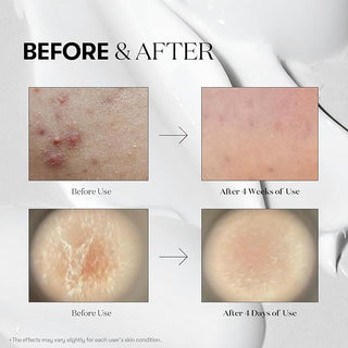 VT Reedle Shot 100 Essence 50mL (+3ml Reedle Shot 300)