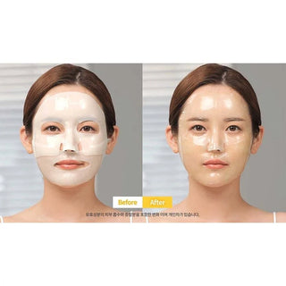 MEDIANSWER Vita Collagen Mask (5 pieces)